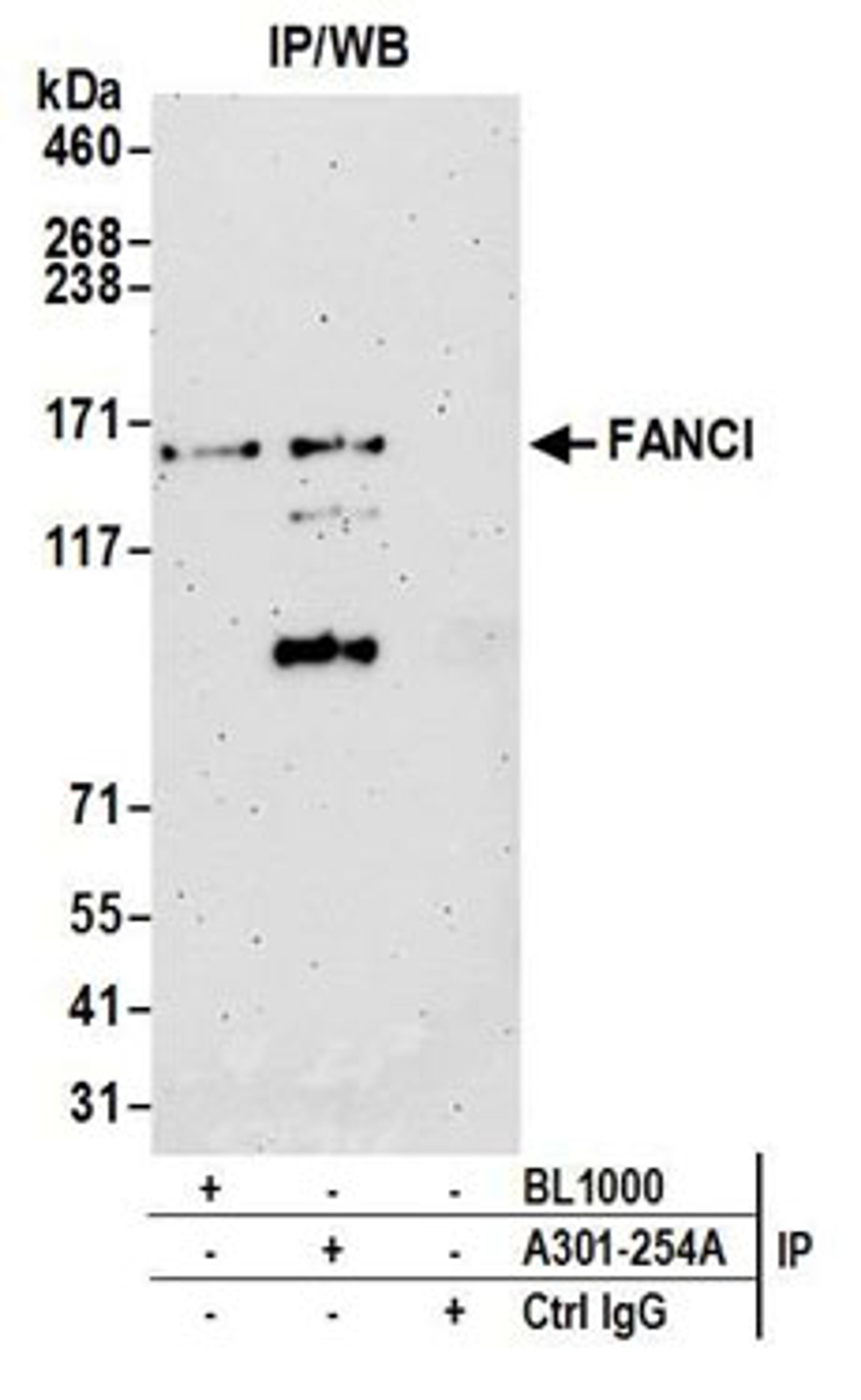 Detection of human FANCI by western blot of immunoprecipitates.