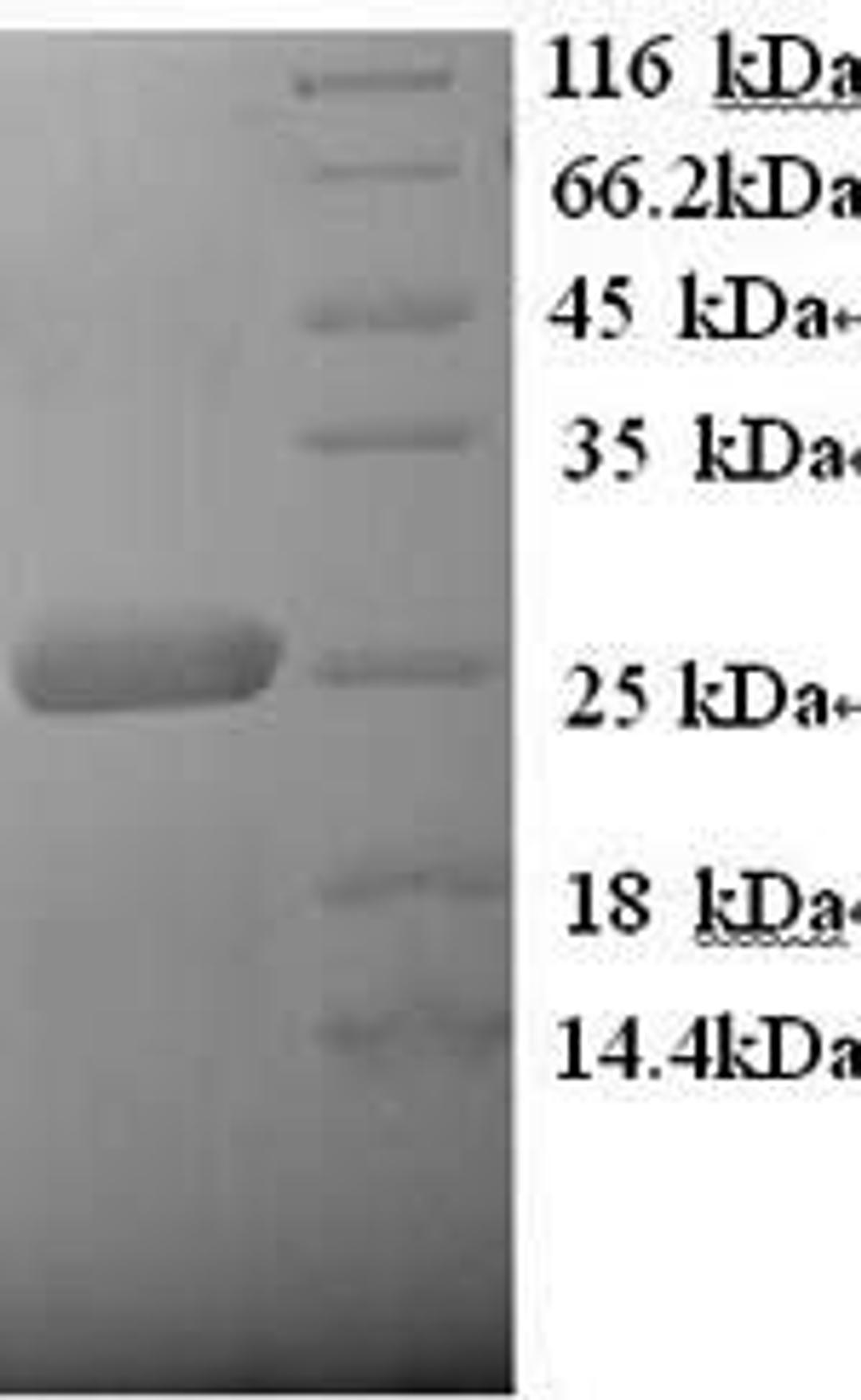 (Tris-Glycine gel) Discontinuous SDS-PAGE (reduced) with 5% enrichment gel and 15% separation gel.