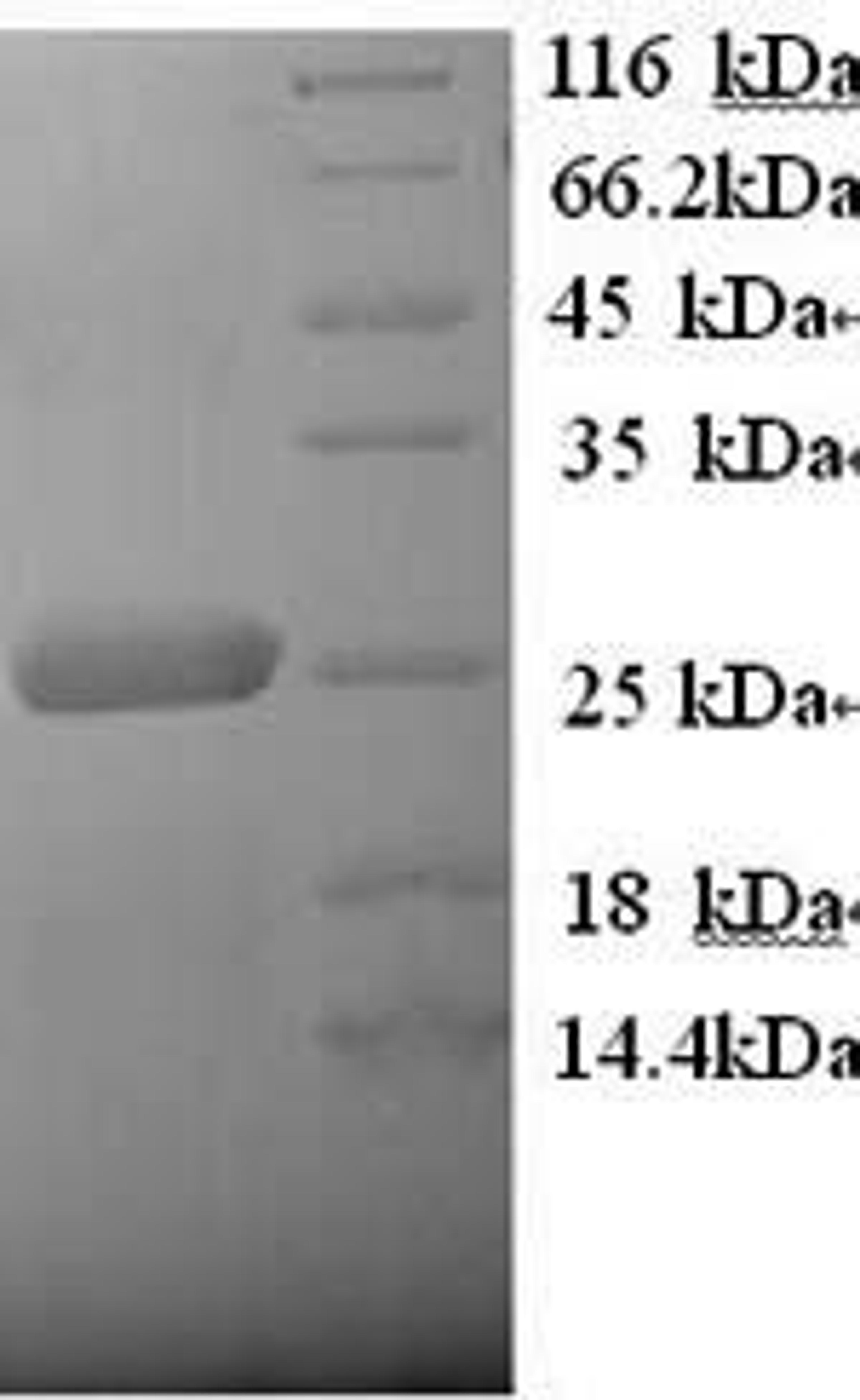 (Tris-Glycine gel) Discontinuous SDS-PAGE (reduced) with 5% enrichment gel and 15% separation gel.