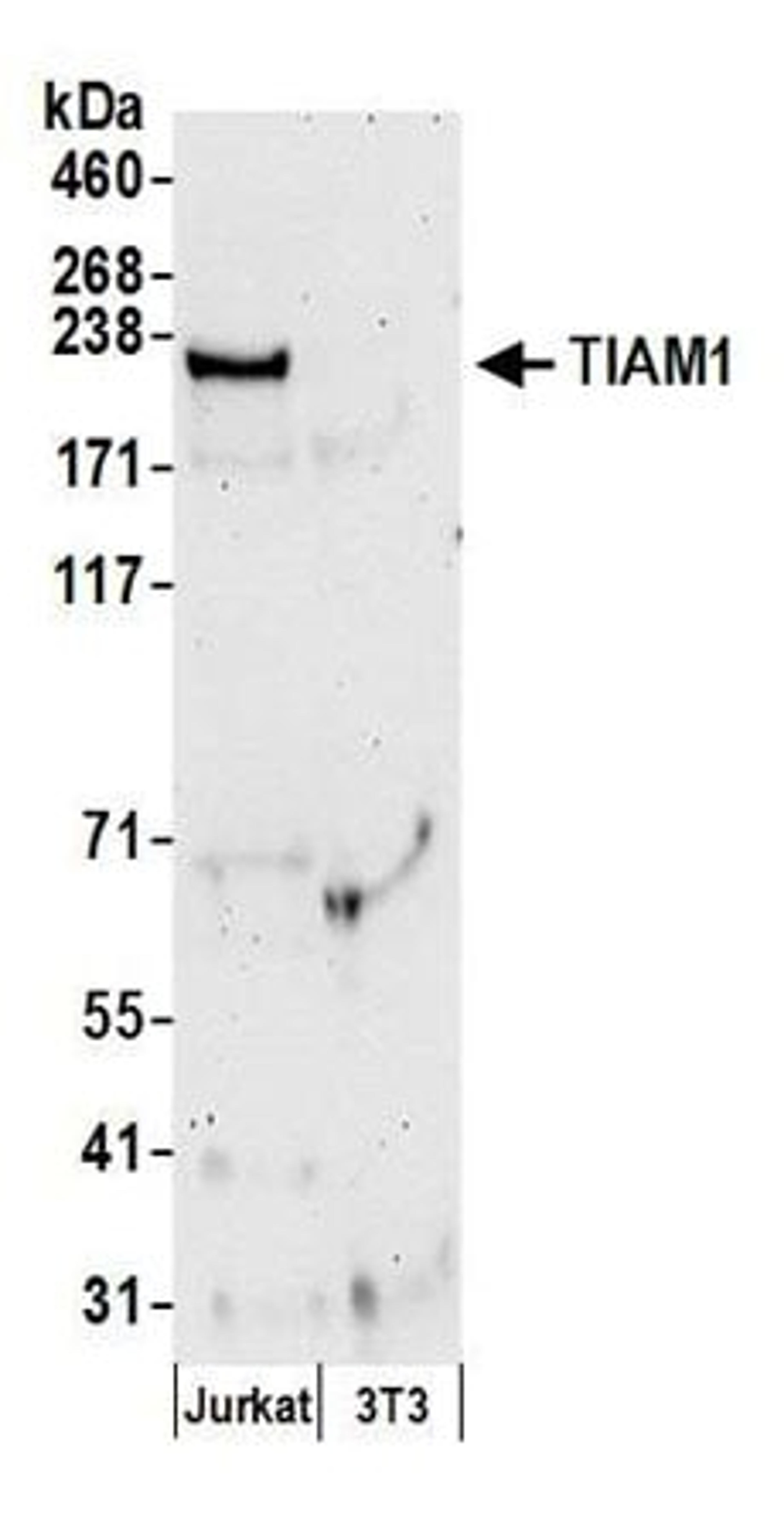 Detection of human and mouse TIAM1 by western blot.