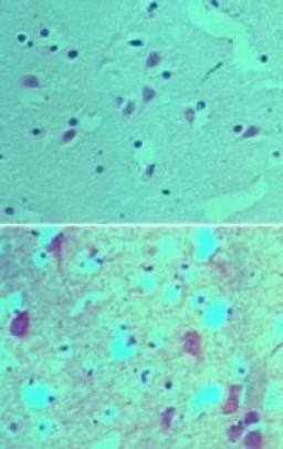 Immunohistochemistry-Paraffin: SOX1 Antibody [NBP2-24486] - Immunohistochemical analysis of SOX1 in formalin-fixed, paraffin-embedded human brain tissue using an isotype control (top) and NBP2-24486 (bottom) at 5 ug/ml.