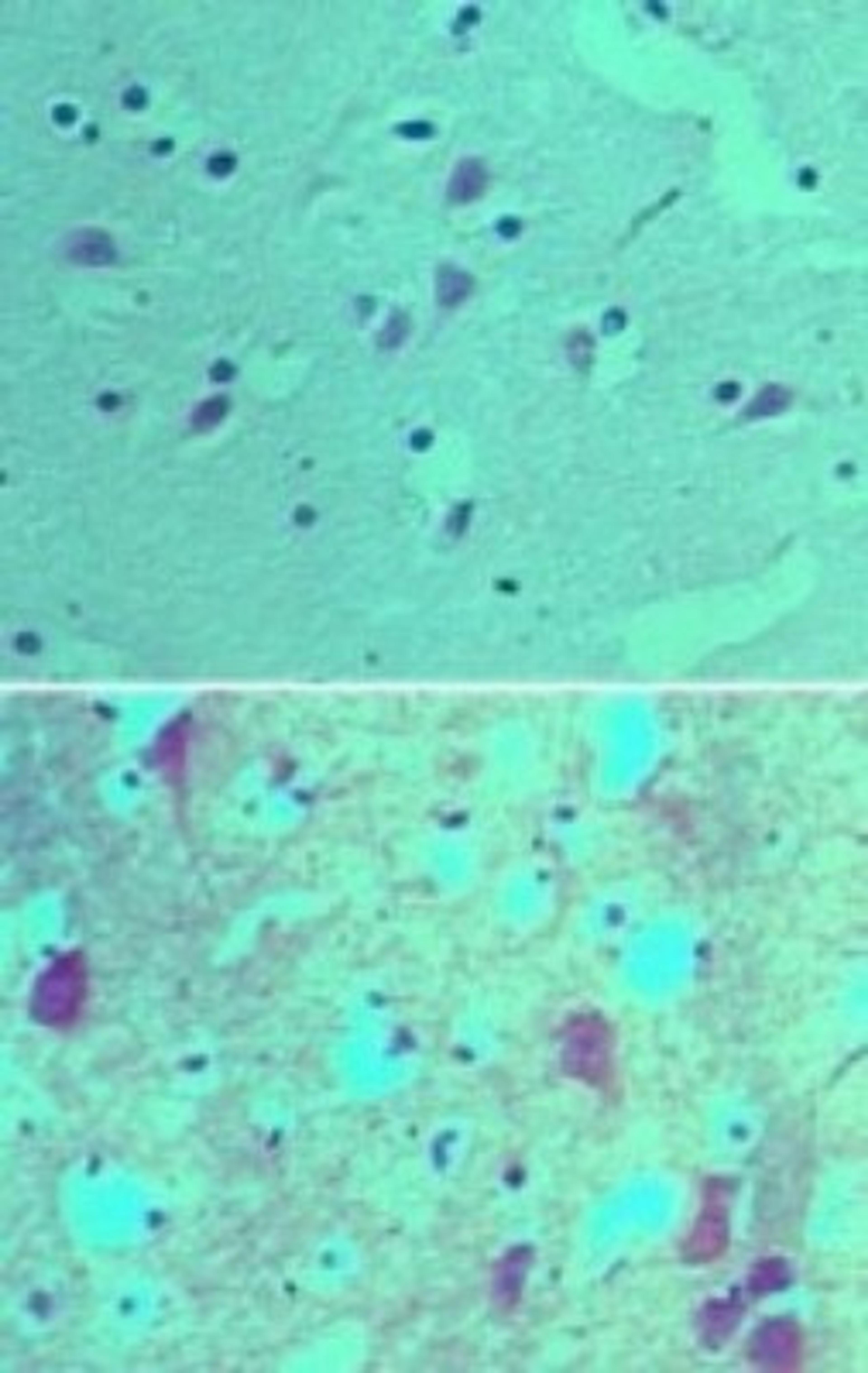 Immunohistochemistry-Paraffin: SOX1 Antibody [NBP2-24486] - Immunohistochemical analysis of SOX1 in formalin-fixed, paraffin-embedded human brain tissue using an isotype control (top) and NBP2-24486 (bottom) at 5 ug/ml.