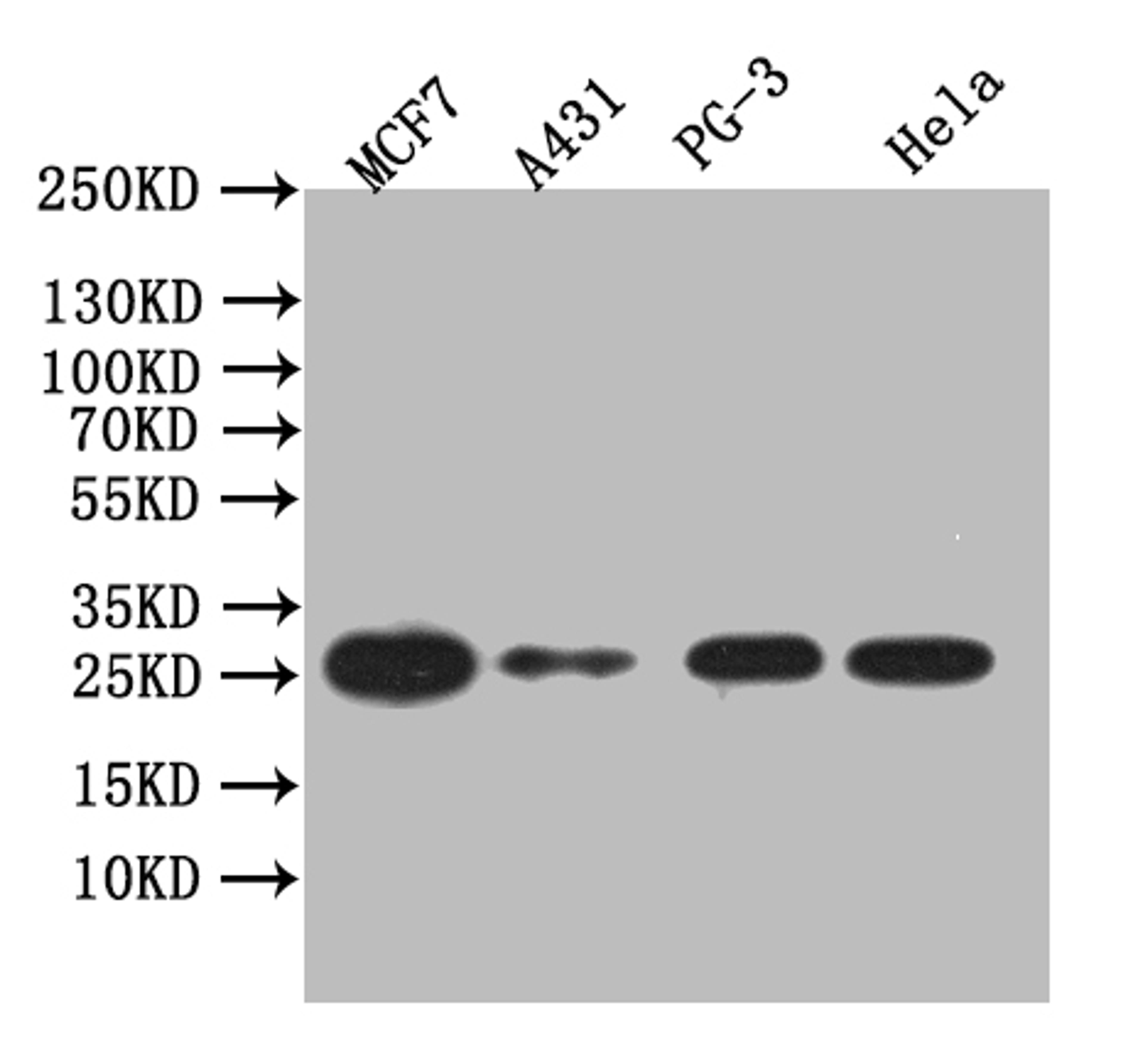 Western Blot. Positive WB detected in: PC-3 whole cell lysate, MCF7 whole cell lysate, Hela whole cell lysate, A431 whole cell lysate. All lanes: LGALS3 antibody at 1:1000. Secondary. Goat polyclonal to human IgG at 1/50000 dilution. Predicted band size: 26 kDa. Observed band size: 26 kDa. 
