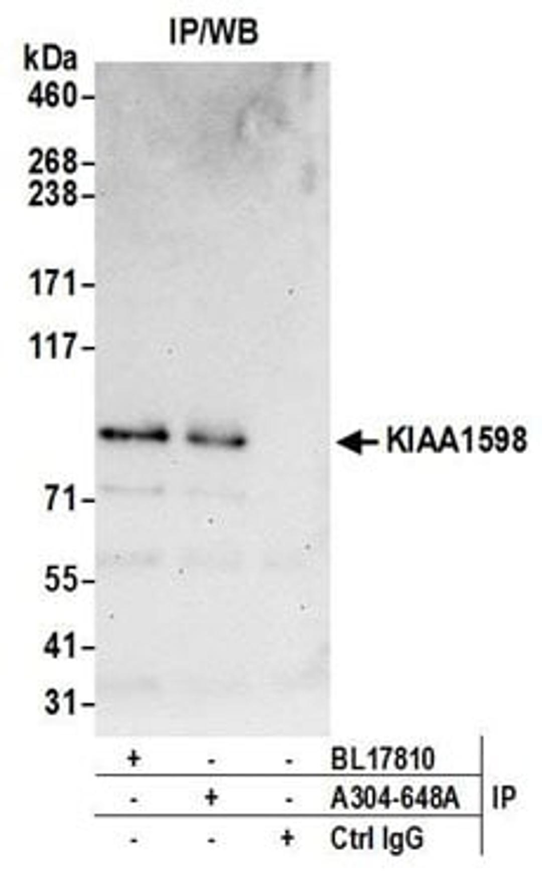 Detection of human KIAA1598 by western blot of immunoprecipitates.