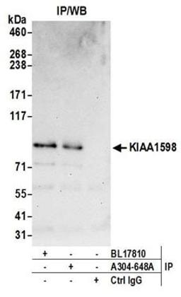 Detection of human KIAA1598 by western blot of immunoprecipitates.