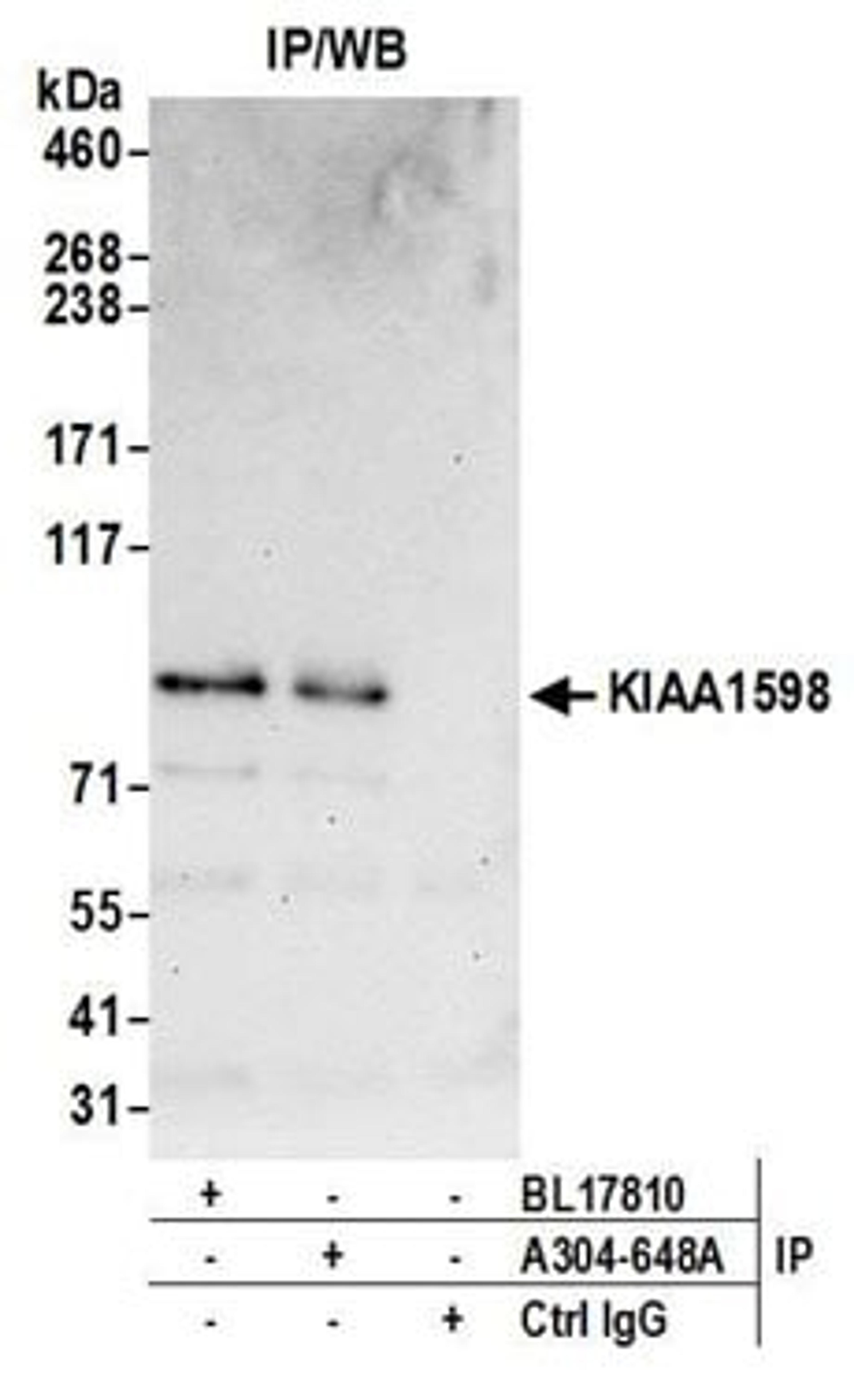 Detection of human KIAA1598 by western blot of immunoprecipitates.