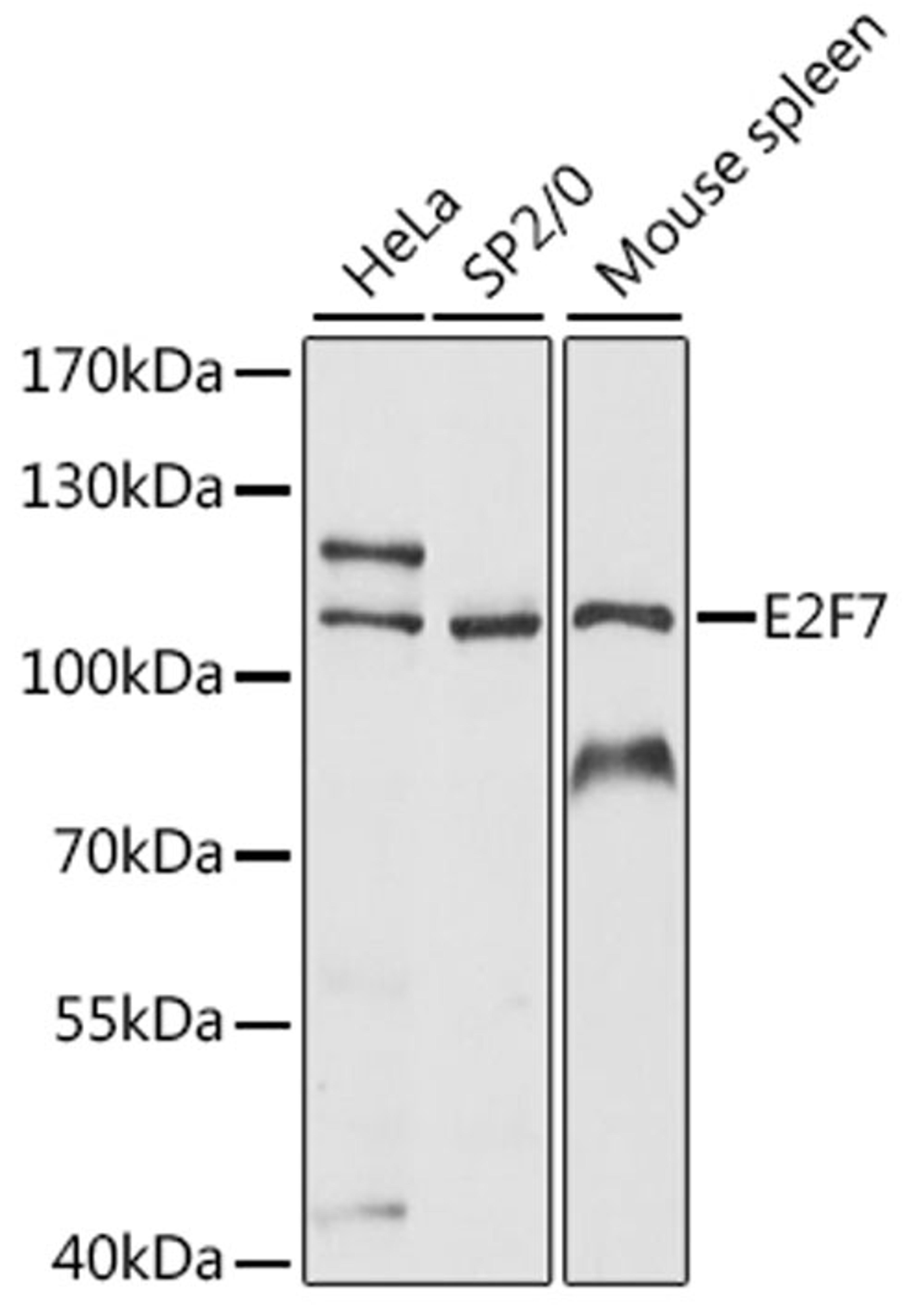 Western blot - E2F7 antibody (A15211)