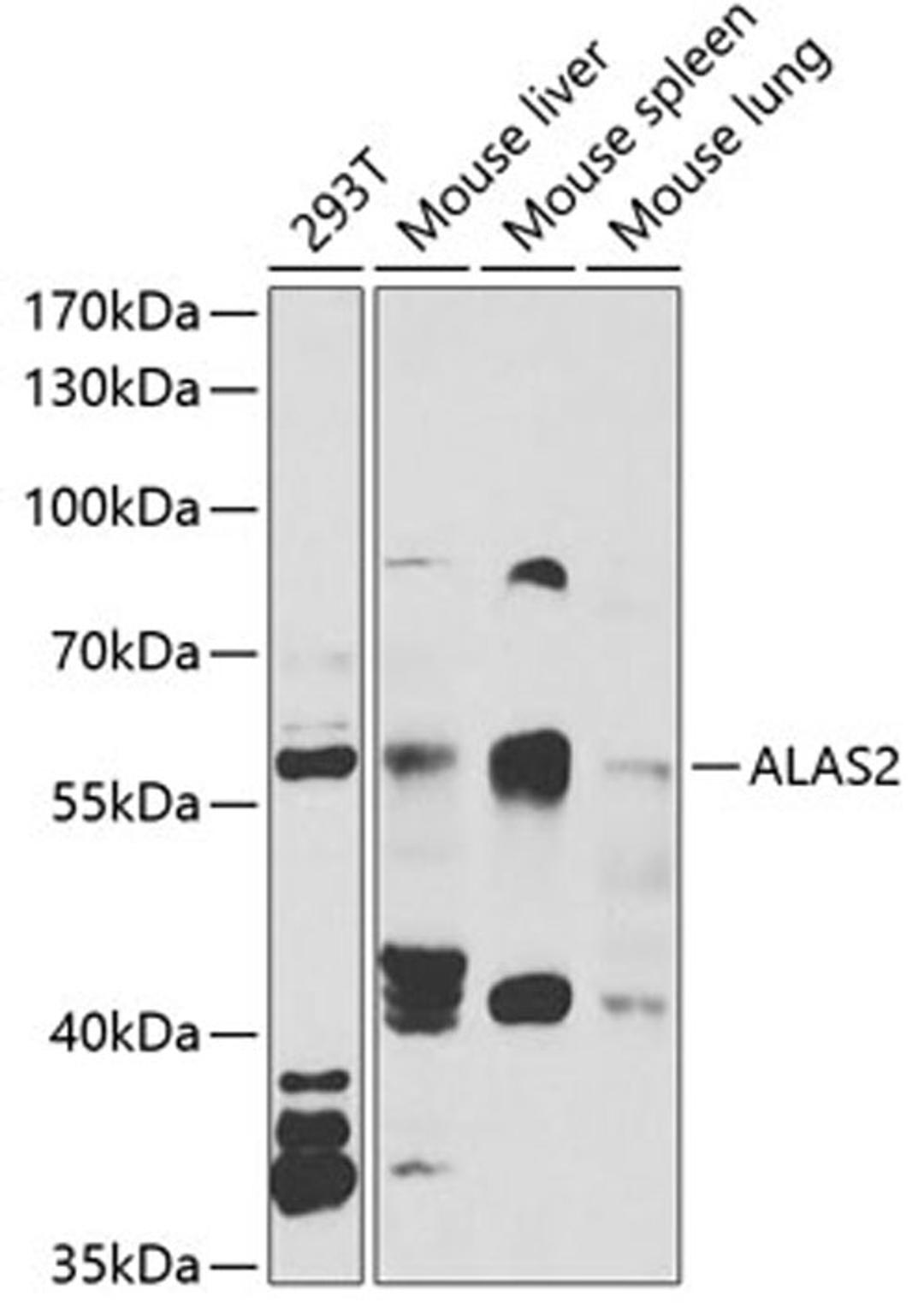 Western blot - ALAS2 antibody (A6522)