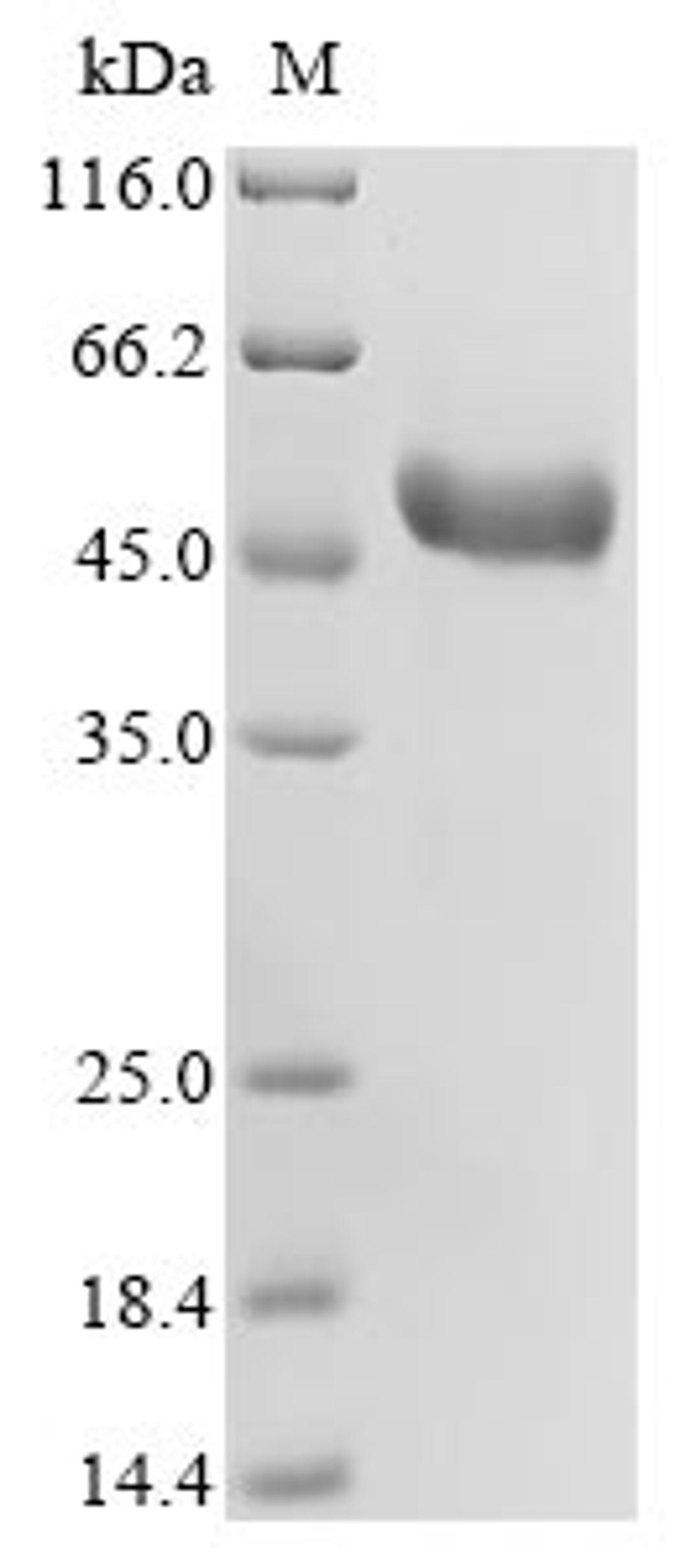 (Tris-Glycine gel) Discontinuous SDS-PAGE (reduced) with 5% enrichment gel and 15% separation gel.