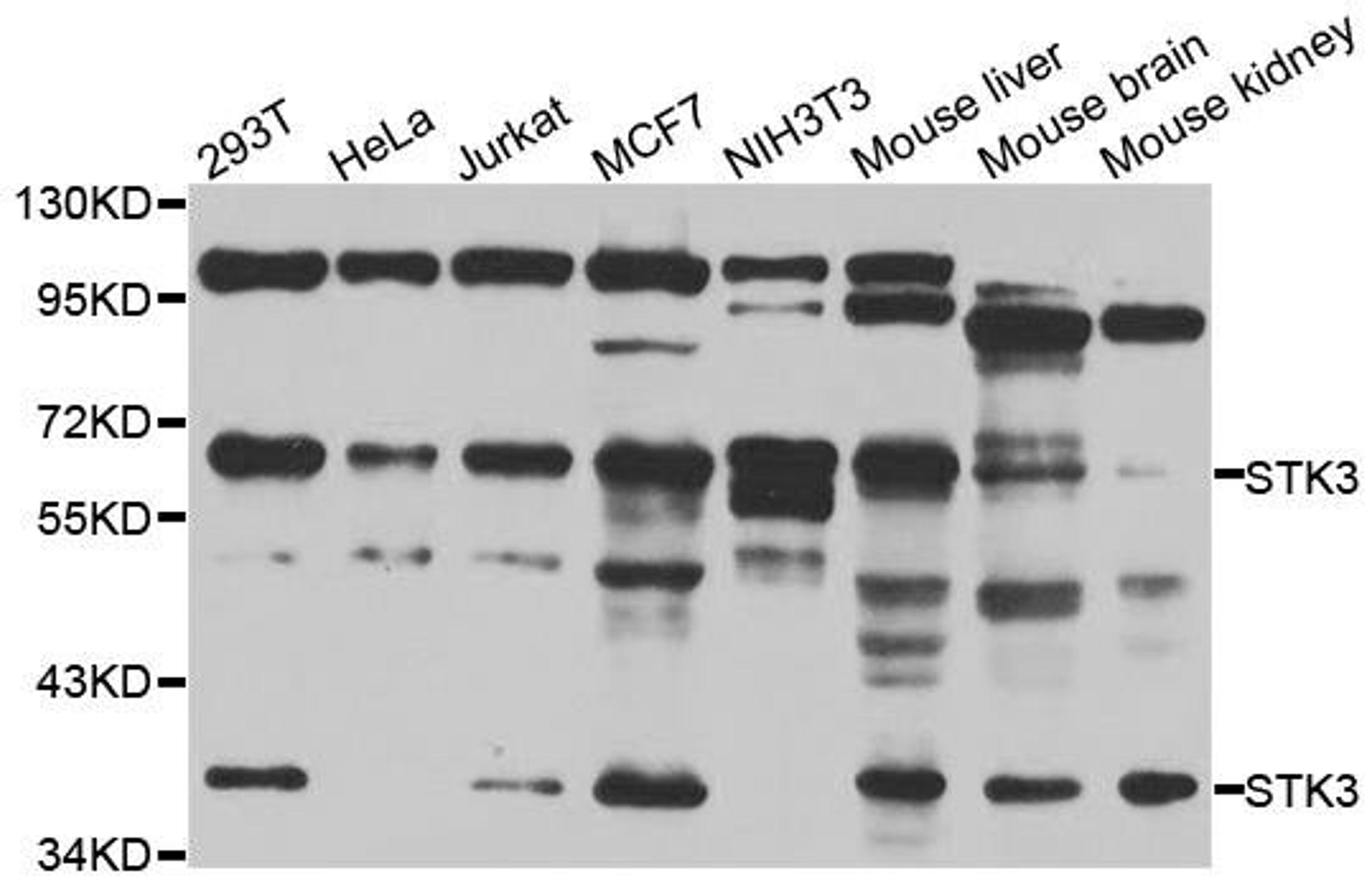 Western blot analysis of extracts of various cell lines using STK3 antibody