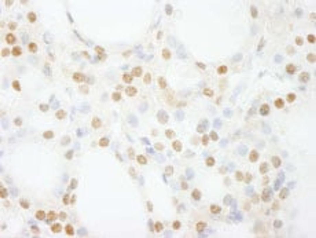 Detection of human GTF3C4/TFIIIC90 by immunohistochemistry.