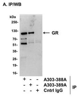 Detection of mouse GR by western blot of immunoprecipitates.