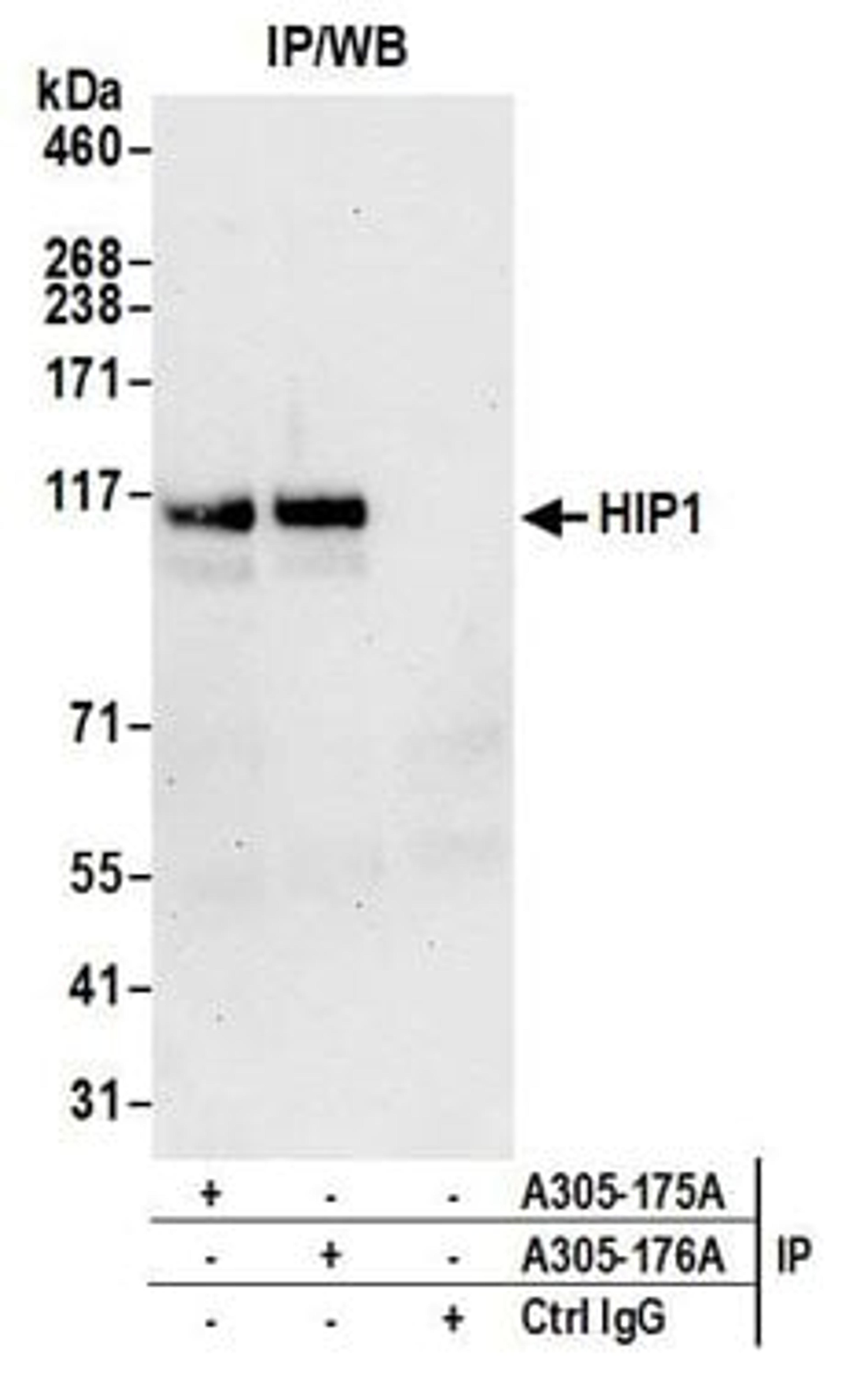 Detection of human HIP1 by western blot of immunoprecipitates.