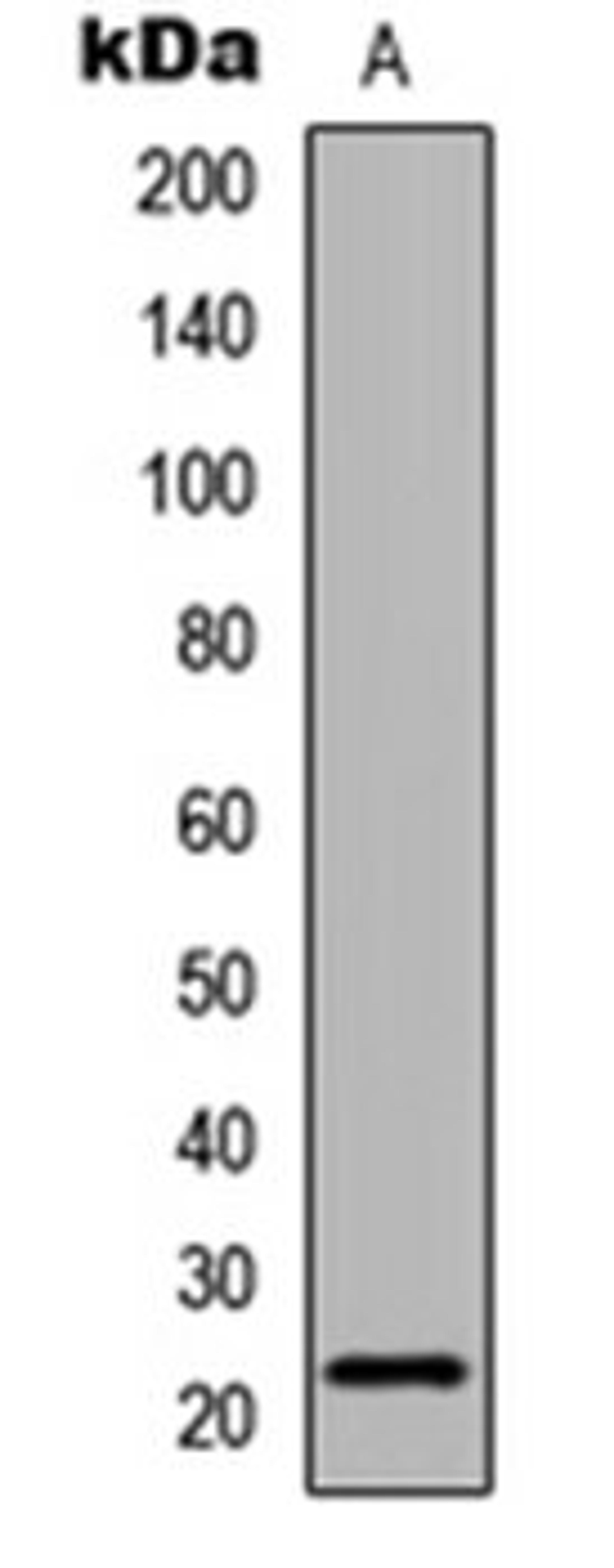 Western blot analysis of COLO205 (Lane 1) whole cell lysates using Claudin 6 antibody