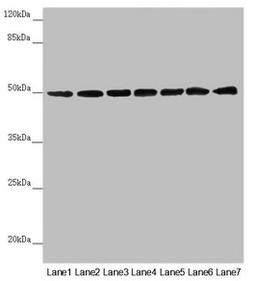 Western blot. All lanes: UQCRC1 antibody at 2.5µg/ml. Lane 1: Mouse large intestine tissue. Lane 2: Mouse kidney tissue. Lane 3: Mouse brain tissue. Lane 4: LO2 whole cell lysate. Lane 5: Hela whole cell lysate. Lane 6: HepG2 whole cell lysate. Lane 7: MCF-7 whole cell lysate. Secondary. Goat polyclonal to rabbit IgG at 1/10000 dilution. Predicted band size: 53 kDa. Observed band size: 53 kDa