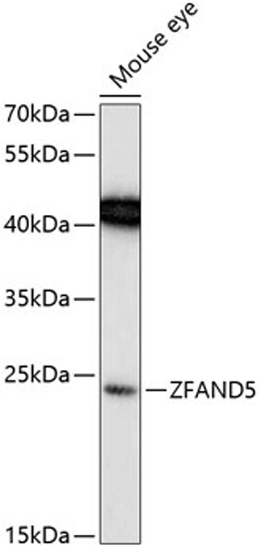 Western blot - ZFAND5 Antibody (A13185)