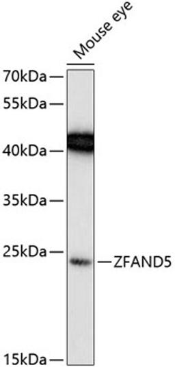 Western blot - ZFAND5 Antibody (A13185)