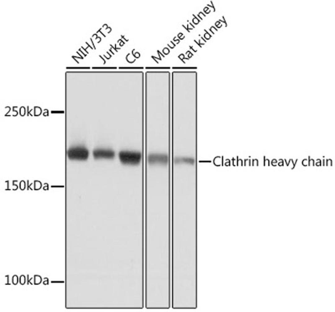 Western blot - Clathrin heavy chain Rabbit mAb (A4943)