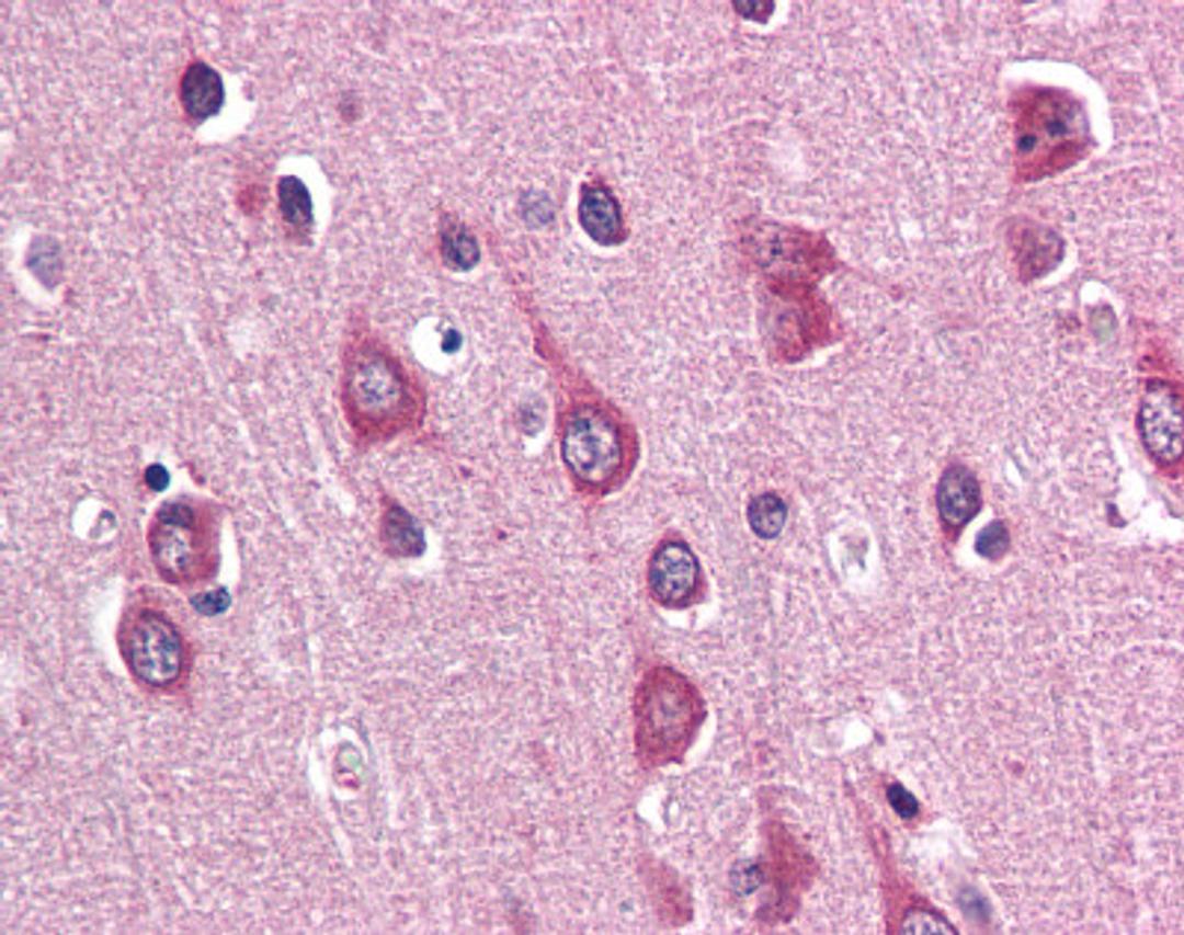 Immunohistochemistry staining of PAK3 in brain cortex tissue using PAK3 Antibody.