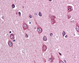 Immunohistochemistry staining of PAK3 in brain cortex tissue using PAK3 Antibody.