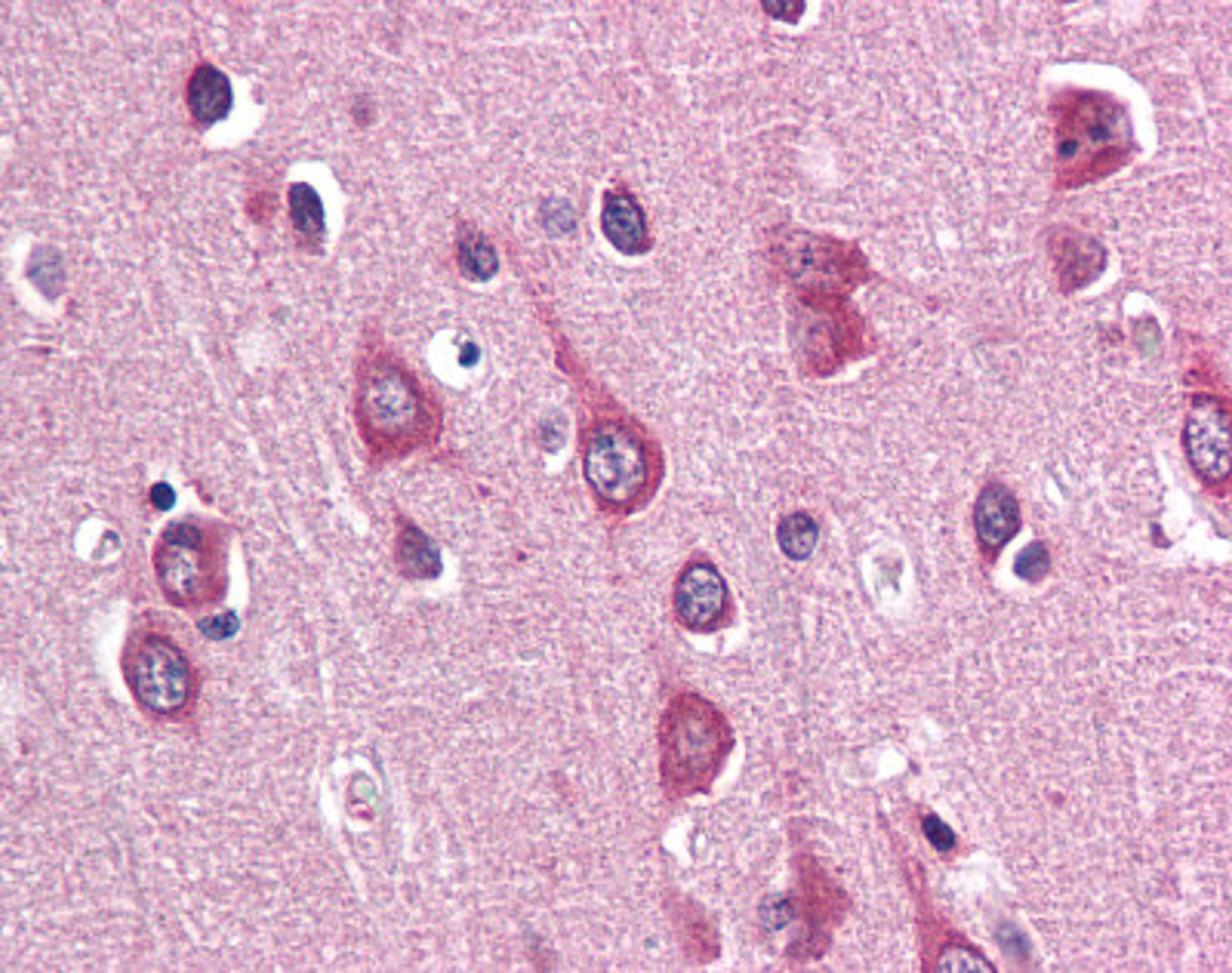 Immunohistochemistry staining of PAK3 in brain cortex tissue using PAK3 Antibody.