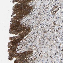 Immunohistochemistry-Paraffin: FGD5 Antibody [NBP1-83877] - Staining of human urinary bladder shows strong cytoplasmic positivity in urothelial cells.