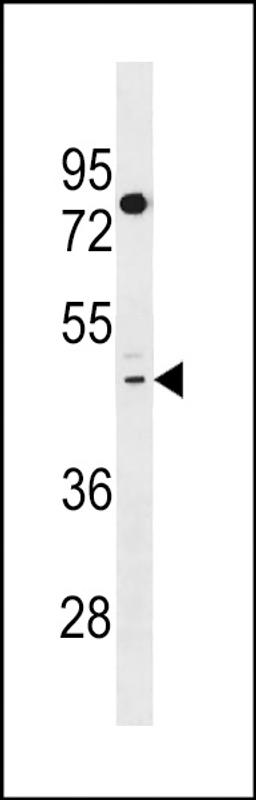 Western blot analysis in HepG2 cell line lysates (35ug/lane).