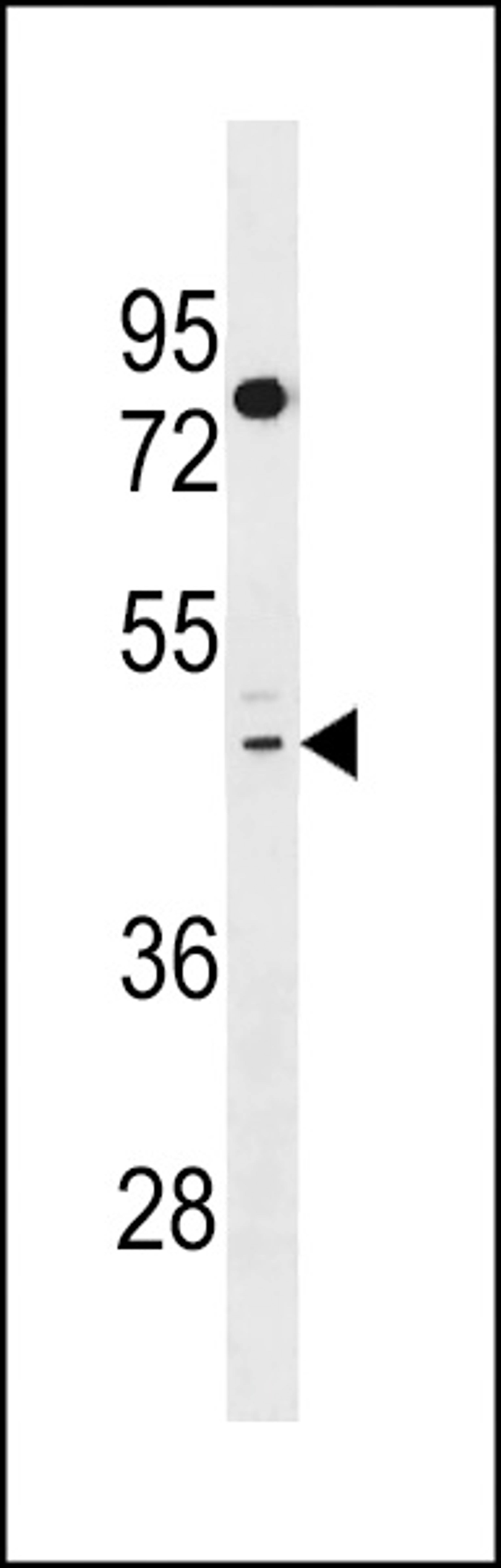 Western blot analysis in HepG2 cell line lysates (35ug/lane).