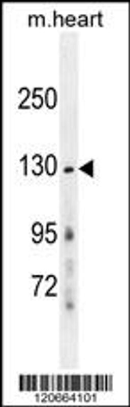 Western blot analysis in mouse heart tissue lysates (35ug/lane).