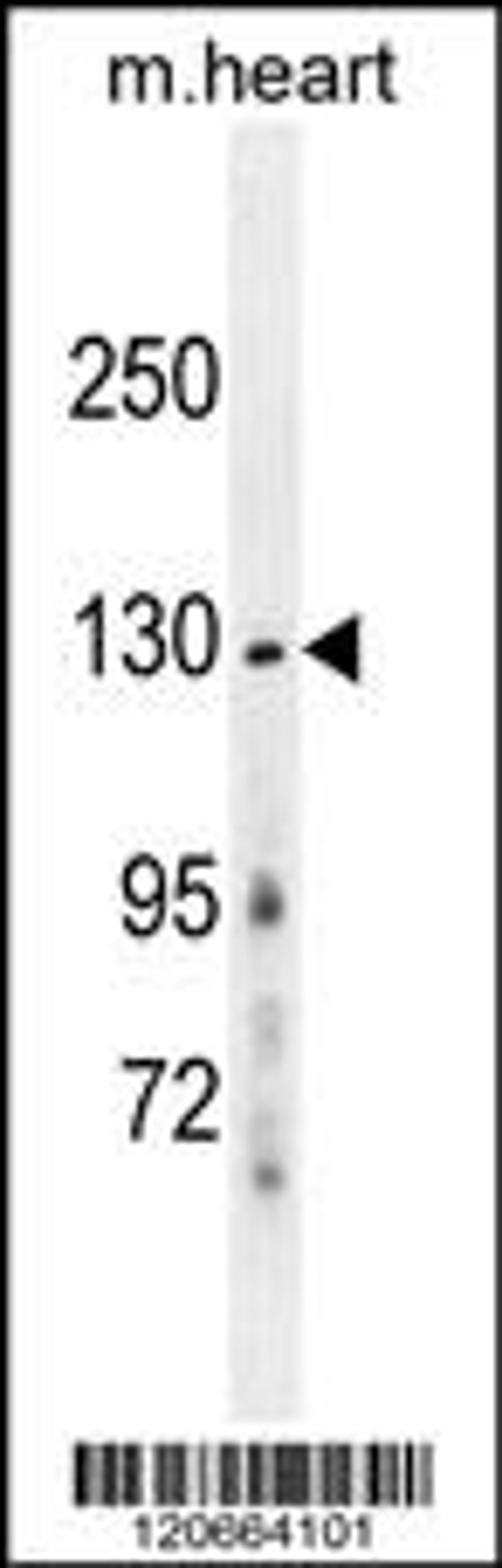 Western blot analysis in mouse heart tissue lysates (35ug/lane).