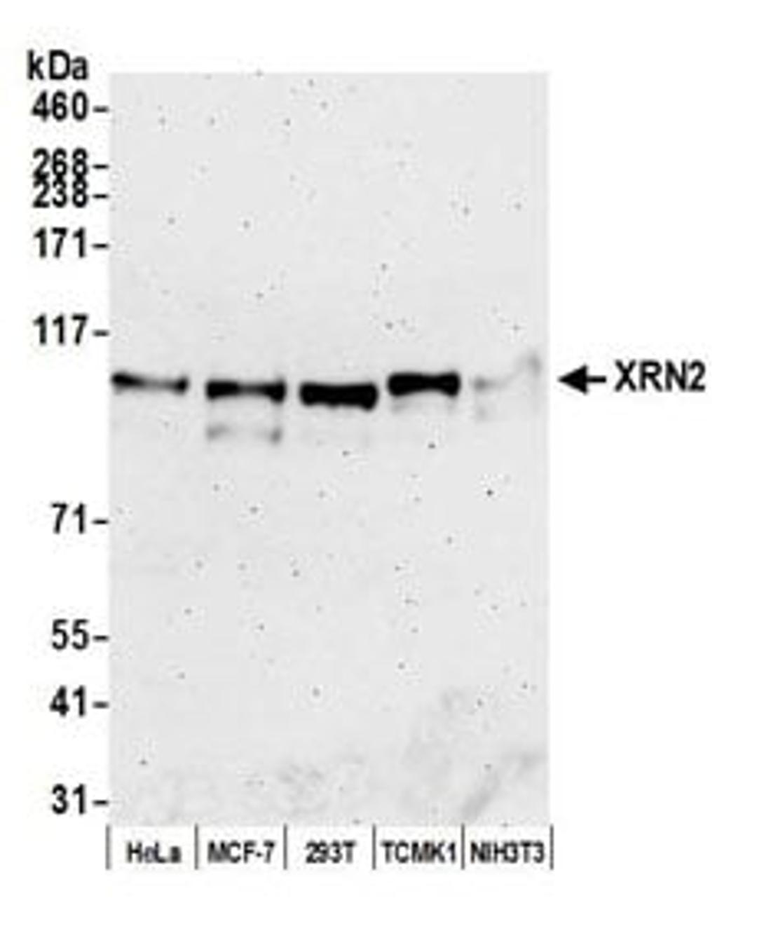 Detection of human and mouse XRN2 by western blot.