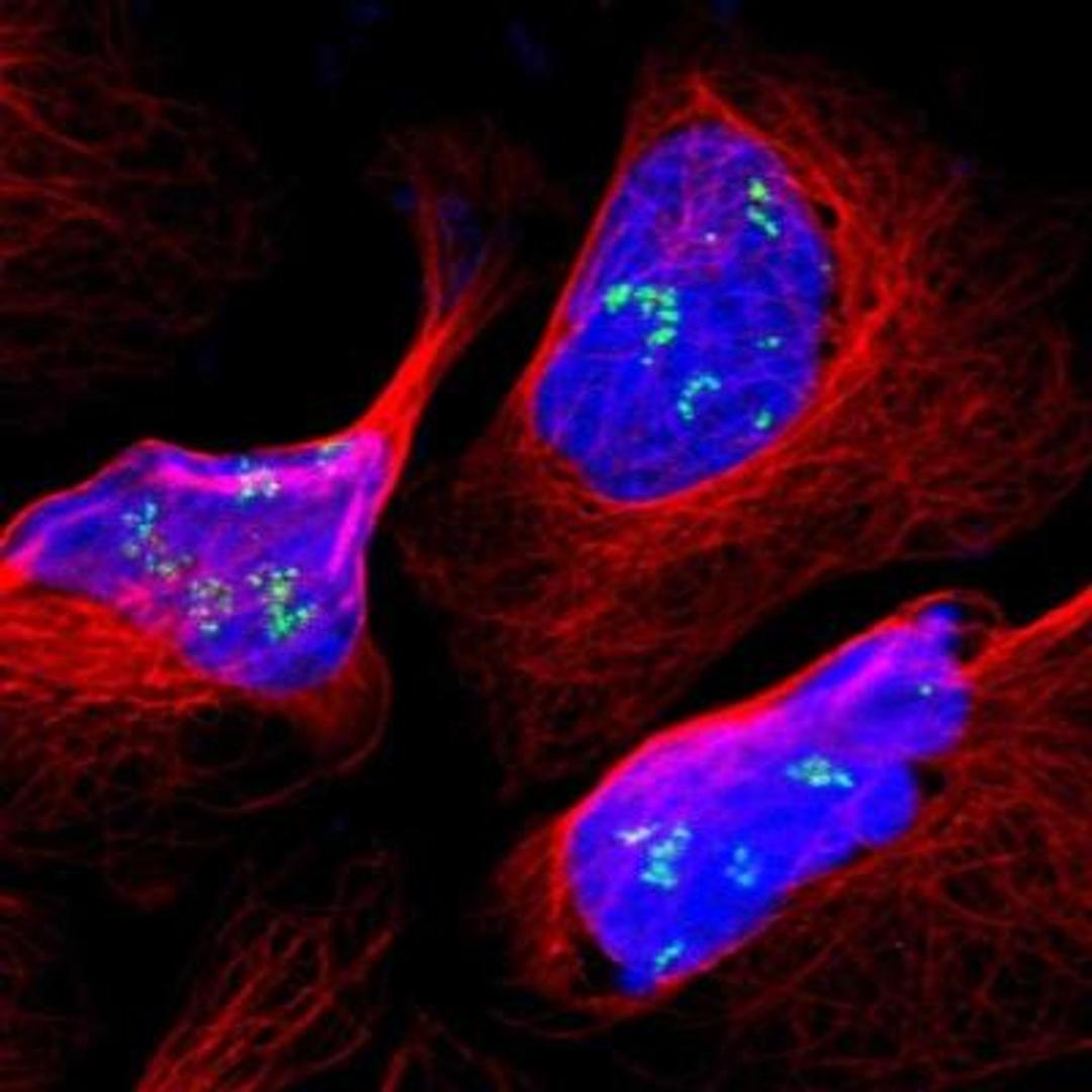 Immunocytochemistry/Immunofluorescence: FLJ23834 Antibody [NBP1-88100] - Staining of human cell line U-2 OS shows positivity in nucleoli.