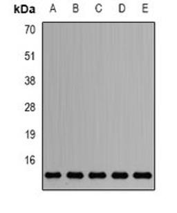 Western blot analysis of HepG2 (Lane1), Jurkat (Lane2), mouse testis (Lane3), mouse heart (Lane4), rat brain (Lane5) whole cell lysates using SNRPD2 antibody