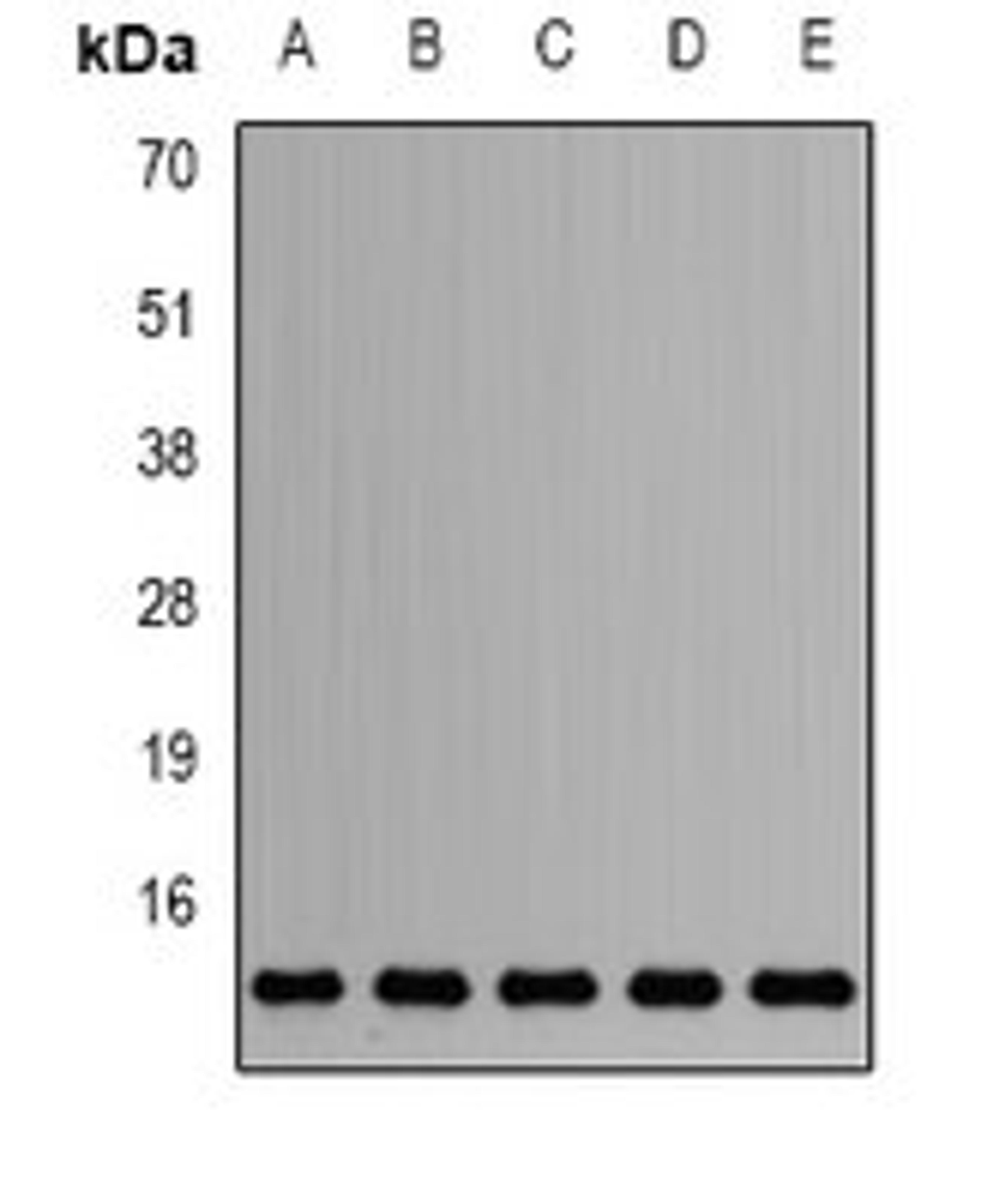 Western blot analysis of HepG2 (Lane1), Jurkat (Lane2), mouse testis (Lane3), mouse heart (Lane4), rat brain (Lane5) whole cell lysates using SNRPD2 antibody