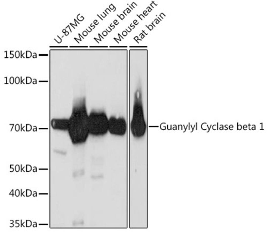 Western blot - Guanylyl Cyclase beta 1 Rabbit mAb (A3687)