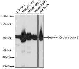 Western blot - Guanylyl Cyclase beta 1 Rabbit mAb (A3687)