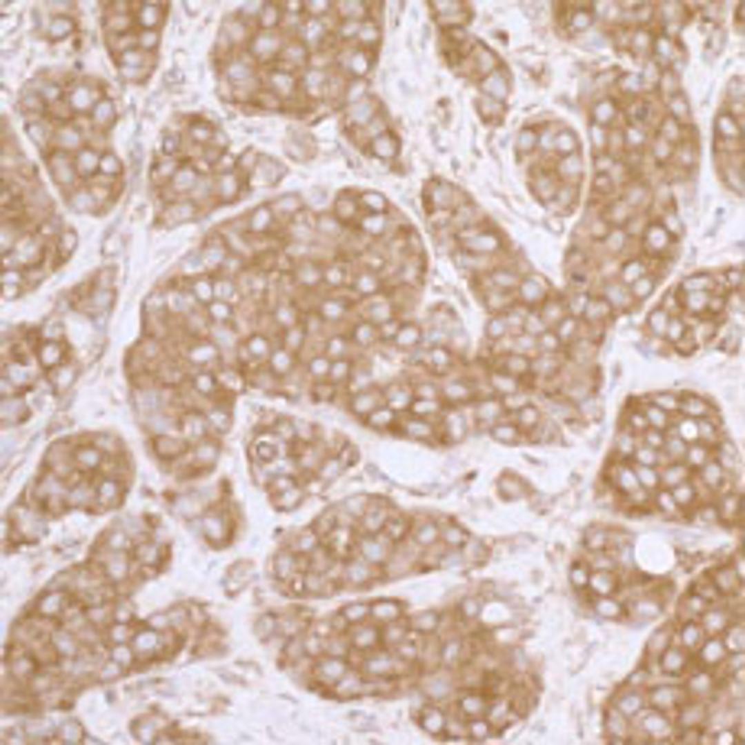 Detection of human eIF3A/EIF3S10 by immunohistochemistry.