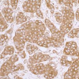 Detection of human eIF3A/EIF3S10 by immunohistochemistry.