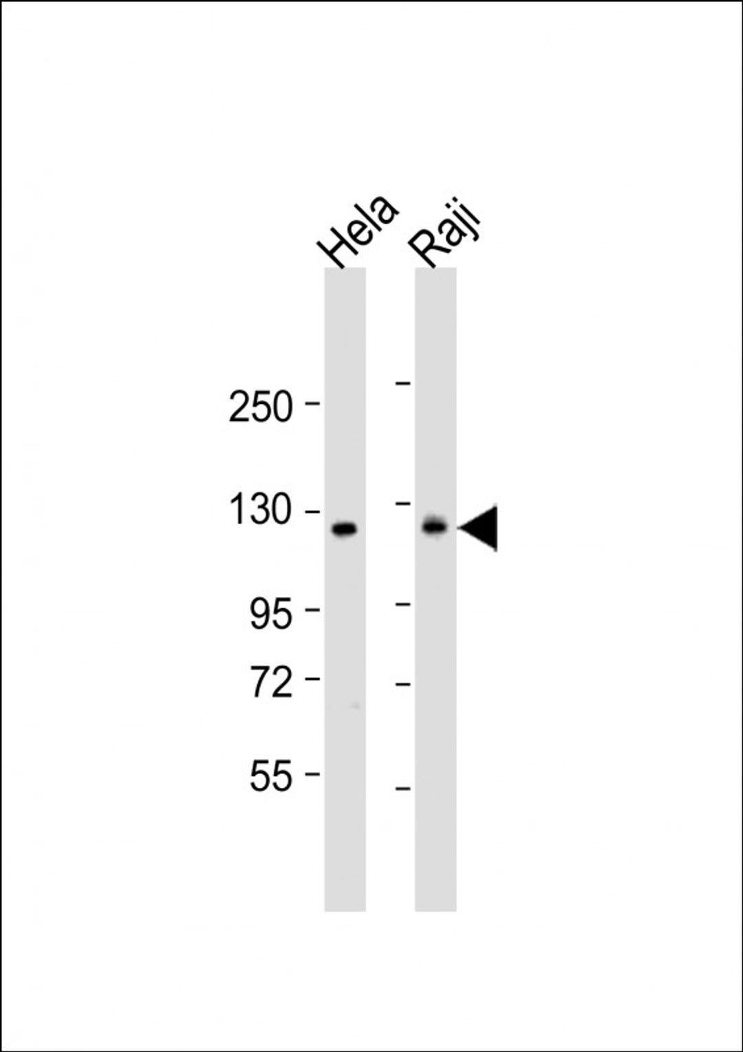 Western Blot at 1:1000 dilution Lane 1: Hela whole cell lysate Lane 2: Raji whole cell lysate Lysates/proteins at 20 ug per lane.