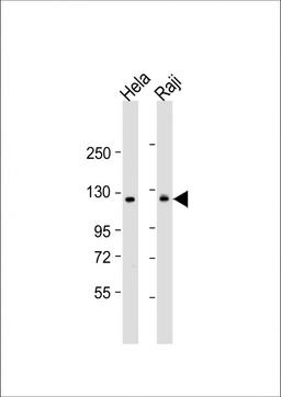 Western Blot at 1:1000 dilution Lane 1: Hela whole cell lysate Lane 2: Raji whole cell lysate Lysates/proteins at 20 ug per lane.