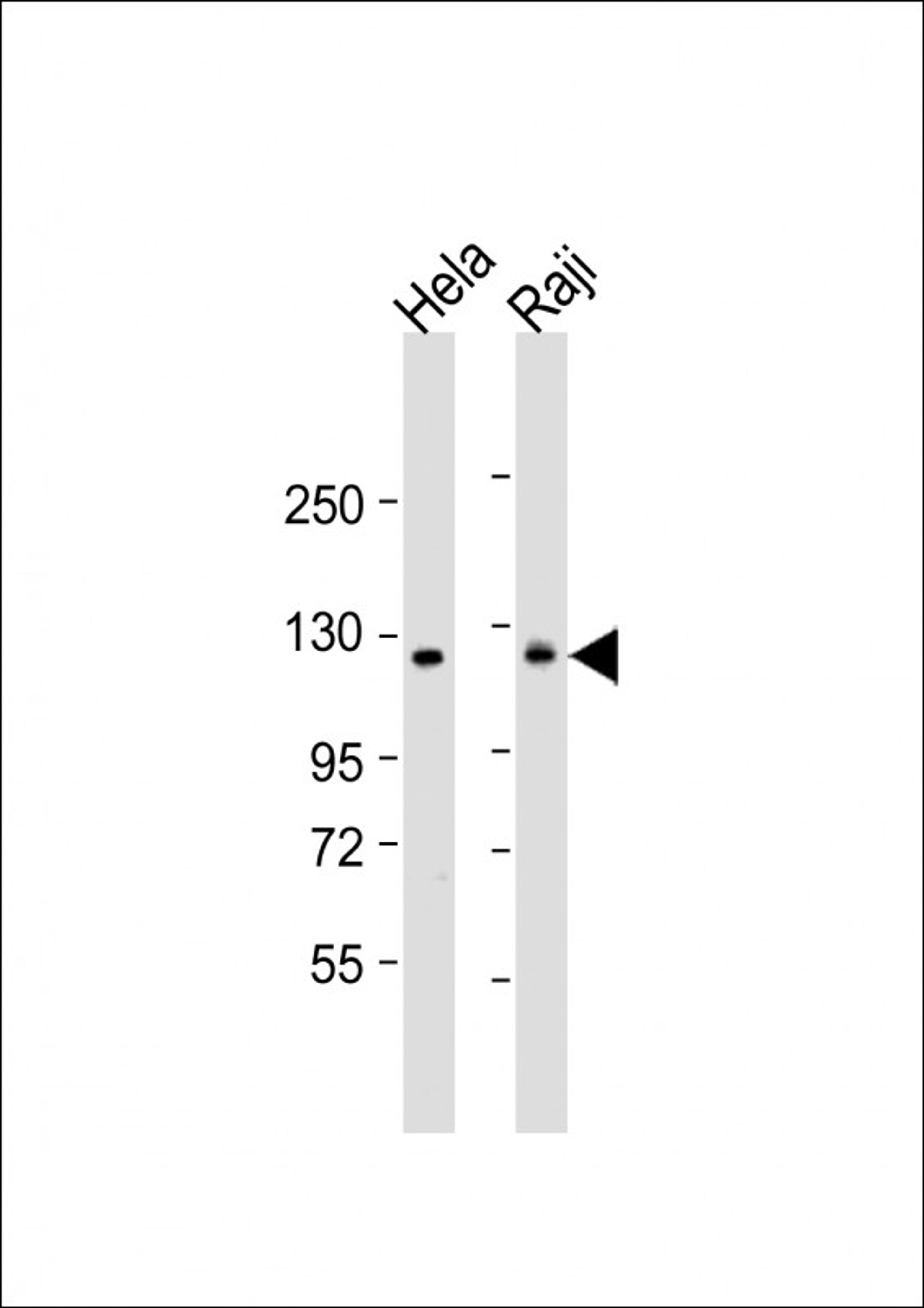 Western Blot at 1:1000 dilution Lane 1: Hela whole cell lysate Lane 2: Raji whole cell lysate Lysates/proteins at 20 ug per lane.