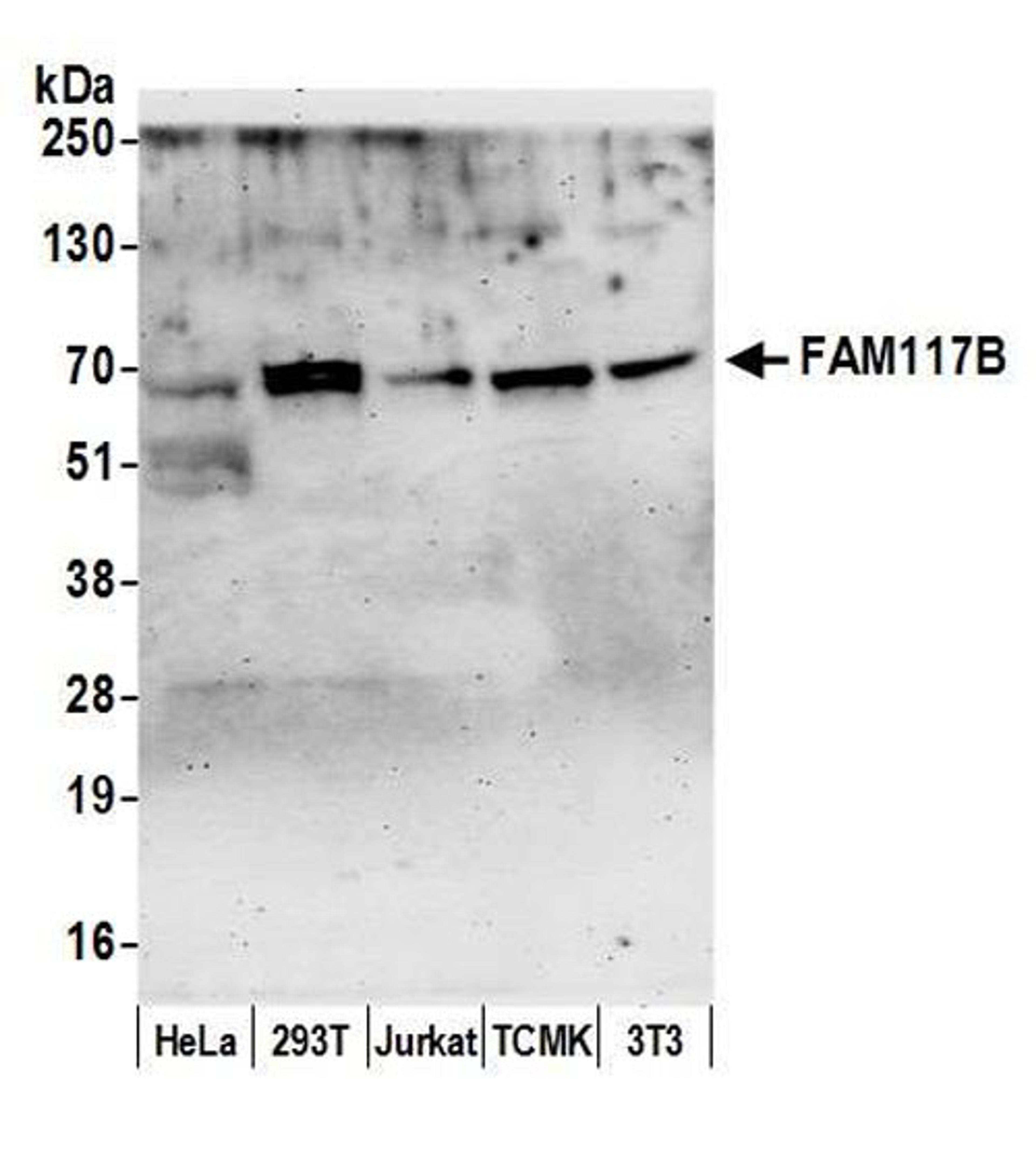 Detection of human and mouse FAM117B by WB.