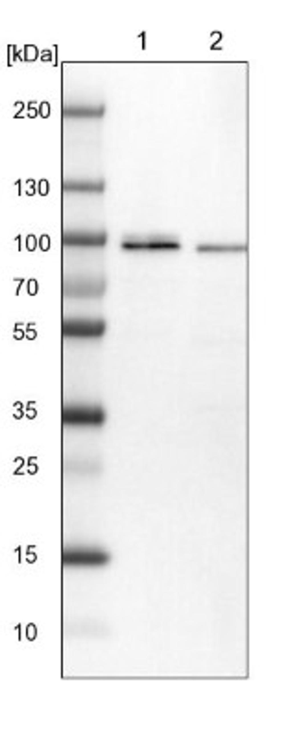 Western Blot: Mark3 Antibody [NBP1-85389] - Lane 1: NIH-3T3 cell lysate (Mouse embryonic fibroblast cells)<br/>Lane 2: NBT-II cell lysate (Rat Wistar bladder tumour cells)