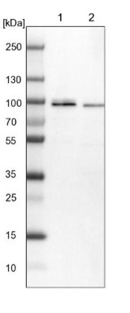 Western Blot: Mark3 Antibody [NBP1-85389] - Lane 1: NIH-3T3 cell lysate (Mouse embryonic fibroblast cells)<br/>Lane 2: NBT-II cell lysate (Rat Wistar bladder tumour cells)