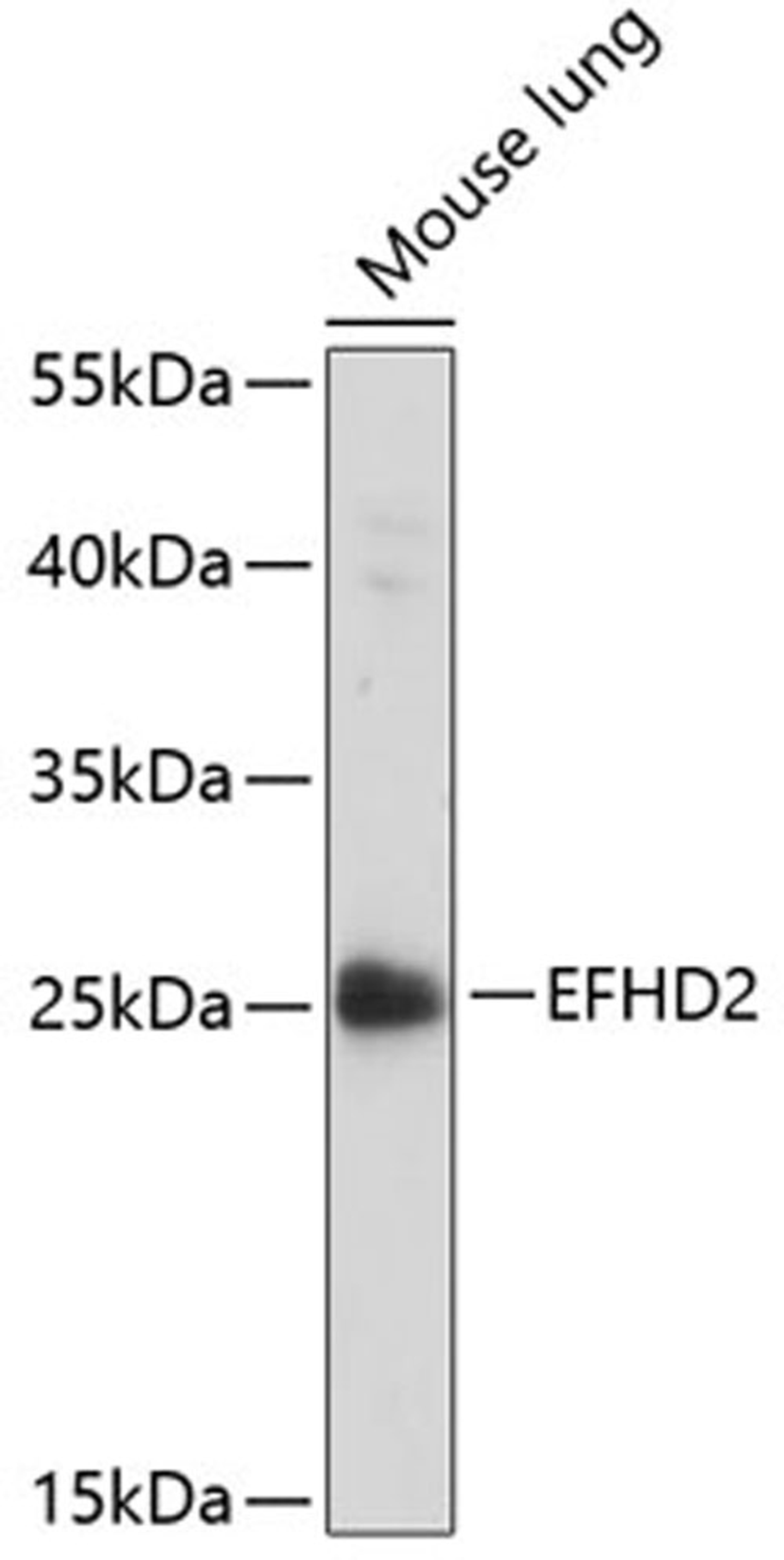 Western blot - EFHD2 antibody (A14926)