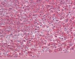 Immunohistochemistry-Paraffin: LY86 Antibody [NB100-56700] - analysis of human spleen using MD-1 antibody at 10 ug/ml.