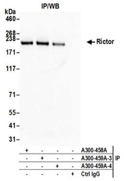 Detection of human Rictor by western blot of immunoprecipitates.