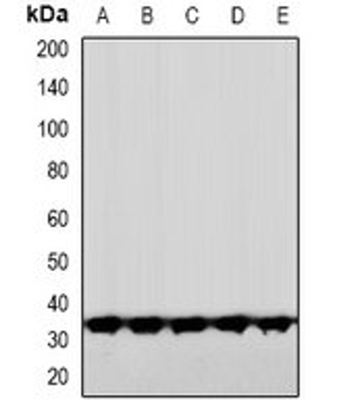 Western blot analysis of HeLa (Lane1), HuvEc (Lane2), DKD (Lane3), mouse brain (Lane4), rat brain (Lane5) whole cell lysates using CNOT7 antibody