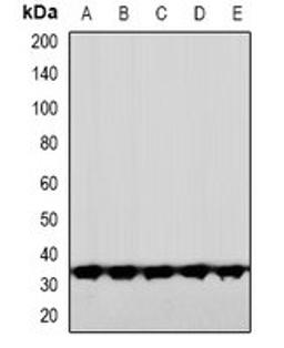 Western blot analysis of HeLa (Lane1), HuvEc (Lane2), DKD (Lane3), mouse brain (Lane4), rat brain (Lane5) whole cell lysates using CNOT7 antibody