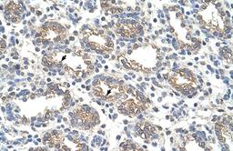 Antibody used in IHC on Human Lung.